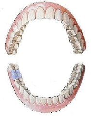 <p>mandibular right second molar</p>