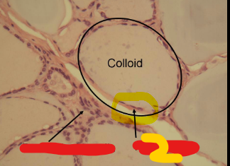 <p>Cells that make up the wall of a follicle. Produces T3 and T4</p>