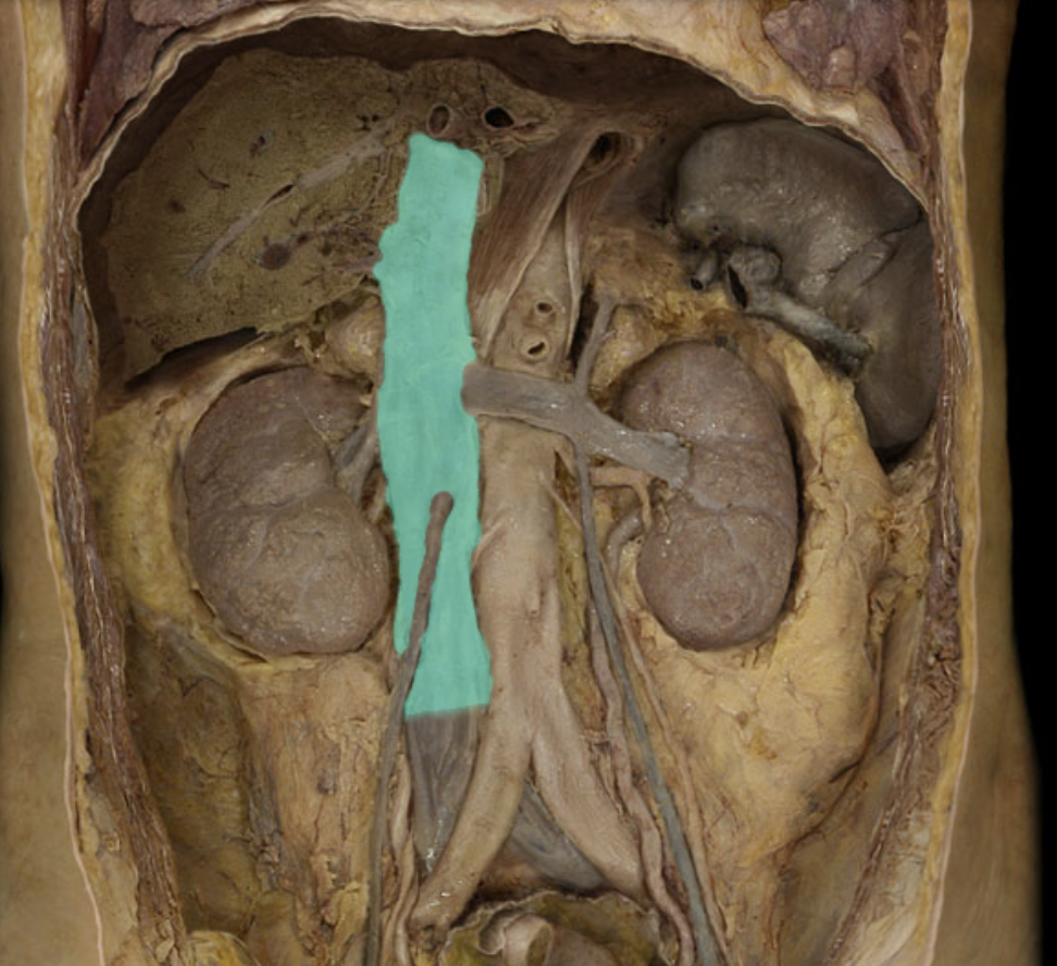 <p>Identify the feature of the caval system</p>