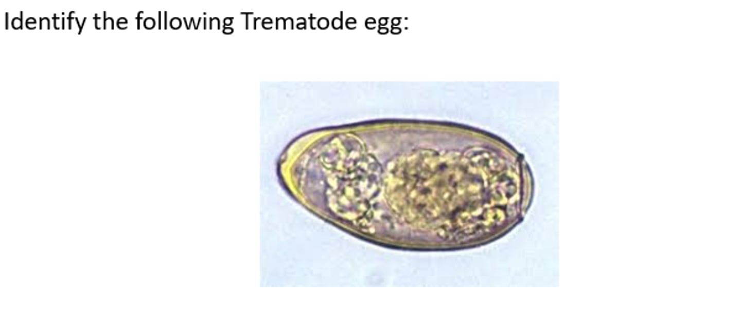 <p>Which Trematode egg is this?</p>