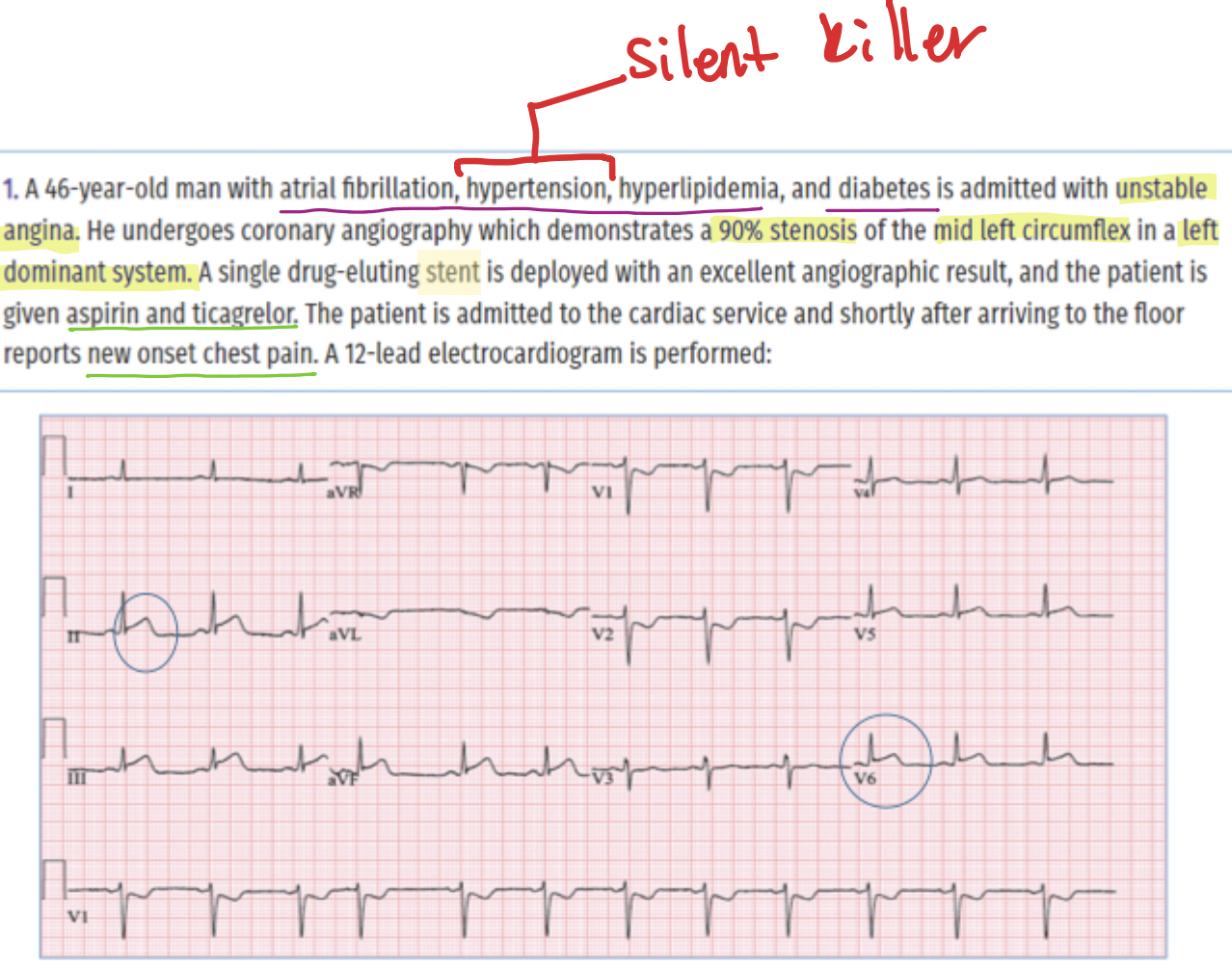 <p>That the <strong>'excellent' blood flow has been interrupted</strong> due to <strong>mechanical failure </strong>(<strong><em>stent thrombosis) —need urgent repeat coronary angiography</em></strong></p>