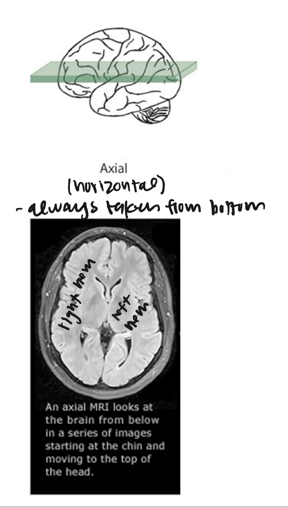 <p>Axial / Horizontal</p><ul><li><p>the image is always taken from the inferior perspective</p></li></ul><p></p>