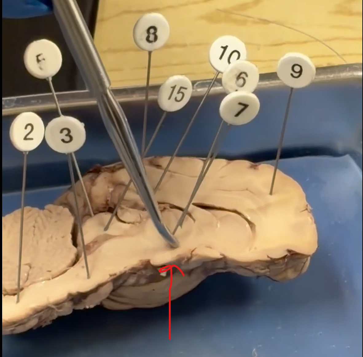 <p>Midline Cut: Structure?</p>