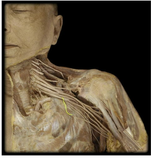 <p>What’s the spinal level of the medial pectoral nerve?</p>