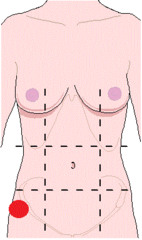 <p>identify the region of the abdomen:</p>