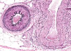 <p>Which vessels have a thin tunica intima and tunica adventitia, a thick tunica media with 6-40 layers of smooth muscle cells, and internal and external elastic laminae? (AKA distributing arteries) (on the left in the image)</p>