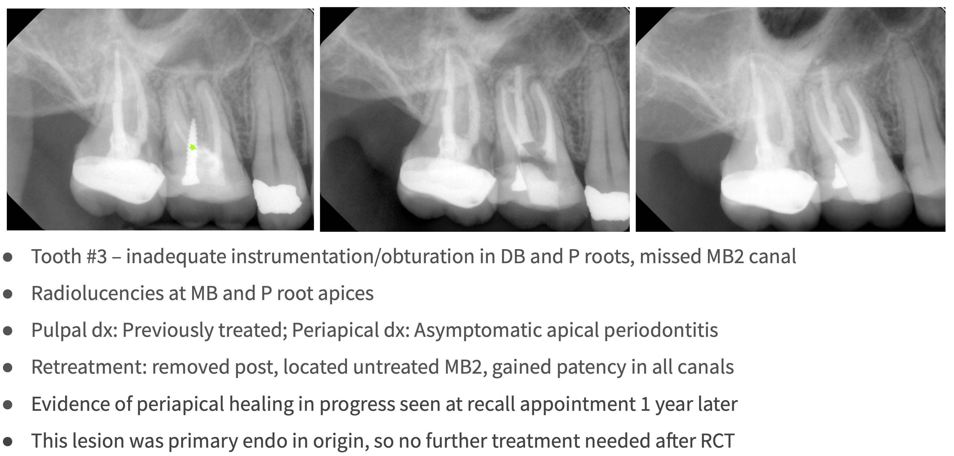 <p>What type of lesion?</p>