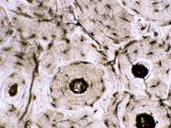 <p>cartilage and bone</p>