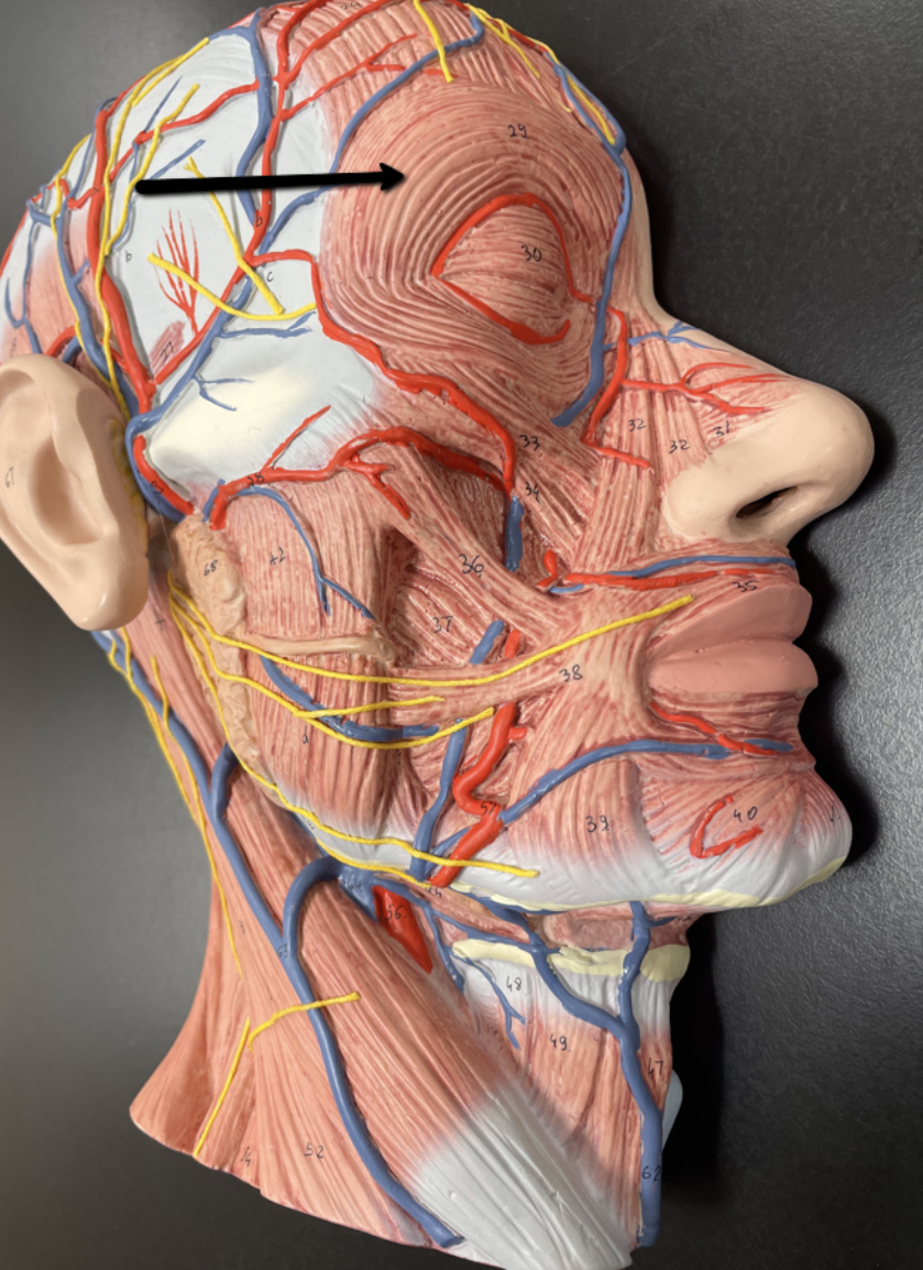 <p>Identify the muscle indicated by the pointer.</p>