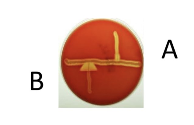 <p>CAMP Test</p><p>a) Medium?</p><p>b) Substrate?</p><p>c) Enzyme?</p><p>d) Indicator/Reagent?</p><p>e) End Product?</p>