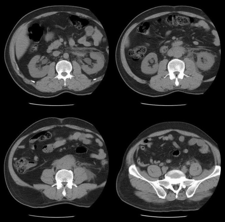 <p>What X-Ray machine was used for this image?</p>