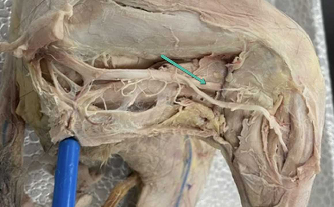 <p><span>Identify the nerve indicated by the pointer.</span></p>