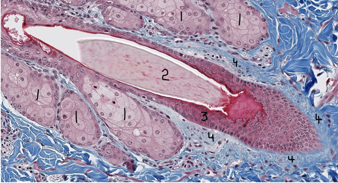 <p>What are 1?</p>