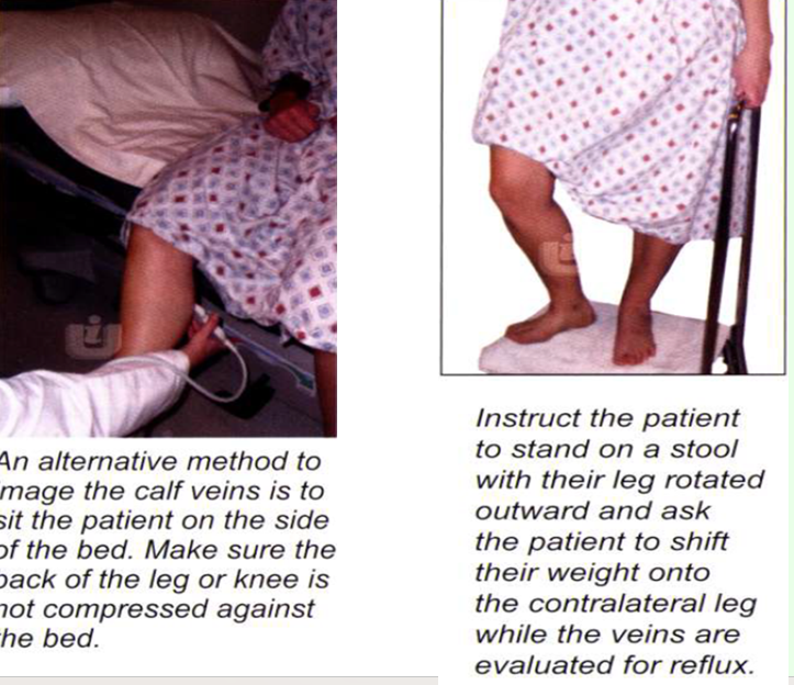 <p>patient examined while standing </p>
