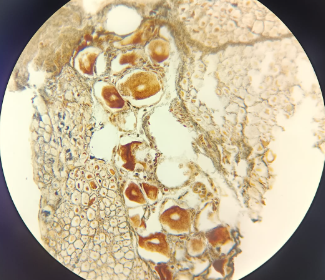 <p>Medulla Spinalis - AgNO3</p><ul><li><p><strong>Organization:</strong> <strong>White matter outside</strong>, <strong>gray matter inside</strong> (butterfly or 'H' shape).</p></li><li><p><strong>Anterior Horn:</strong> Contains very large <strong>alpha motor neurons</strong> that innervate skeletal muscles.</p></li><li><p><strong>Central Canal:</strong> Lined with <strong>ependymal cells</strong> (simple columnar with microvilli/cilia) which produce <strong>cerebrospinal fluid</strong>.</p></li><li><p><strong>Note:</strong> The description is the <strong>same for HE or Silver staining</strong>, but silver clearly shows the cell shape</p></li></ul><p></p>