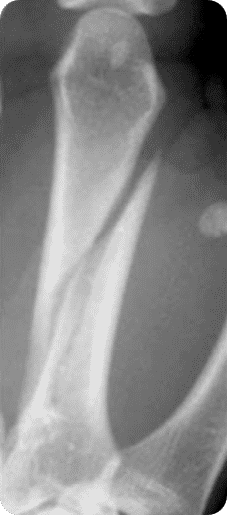 <p>Oblique </p>