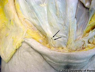 <p>what structure is being indicated to in the image</p>