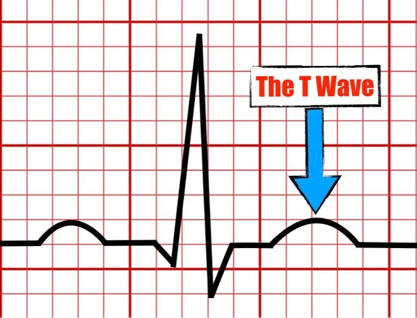 <p>T wave</p>