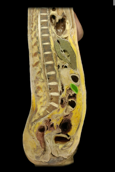<p><span>Transverse colon</span></p>