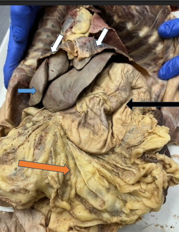 <p>What are each of the arrows pointing to?</p>