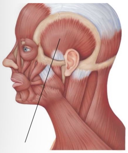 <p>Temporalis actions</p>