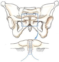 <p>Joints united by cartilaginous tissue, Limited movement</p>