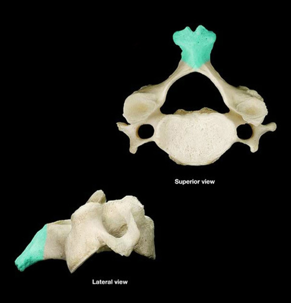 <p>On all vertebrae</p>
