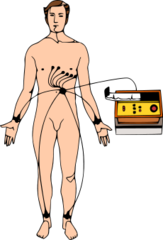 <p>Heart rate </p><p>Arterial blood pressure </p><p>ECG activity </p><p>Pulse oximetry</p>