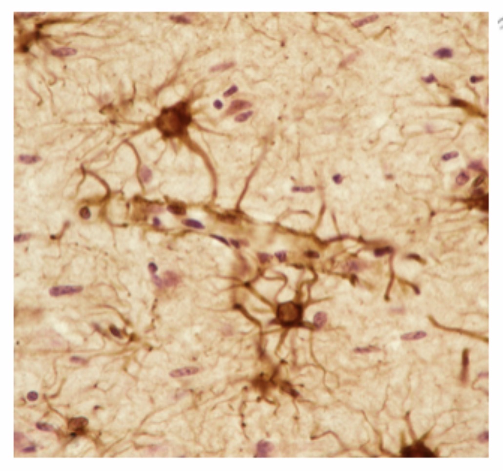 <p>Astrocyte: Function: <span>Support neurons, maintain the blood-brain barrier, regulate chemicals, and help repair the CNS.</span></p>