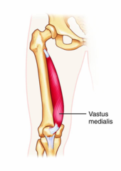 <p>intertrochanteric line of femur,</p><p>linea aspera of femur,</p><p>pectineal line of femur</p>