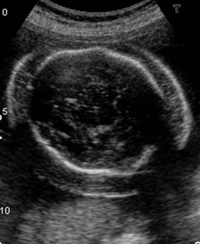 <p>What is seen in this image?</p>