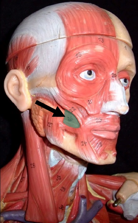 term image