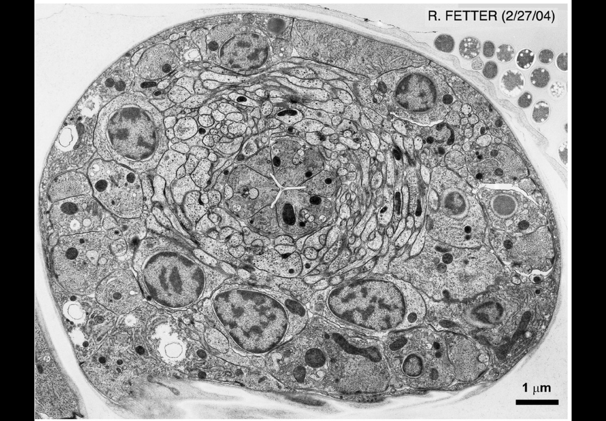 <p>¿Que tipo de microscopia es y que permite observar?</p>