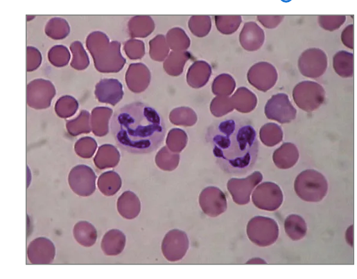 <ul><li><p>What percentage of all leukocytes do neutrophils make up? <br></p></li><li><p>How are neutrophils identified?<br><br></p></li></ul><p></p>