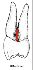 <p>- root trunk with Buccal and Lingual root branch</p><p>- root trunk is between the cervical line and the point of furcation or branching</p><p>- bifurcated for about half its length</p>