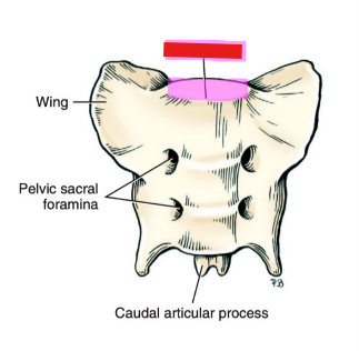 <p>Q: The transverse ridge that forms the dorsal boundary of the pelvic inlet on the sacrum is the …… </p><p>A. Promontory </p><p>B. Wing </p><p>C. Ilium </p><p>D. Xiphoid process</p>
