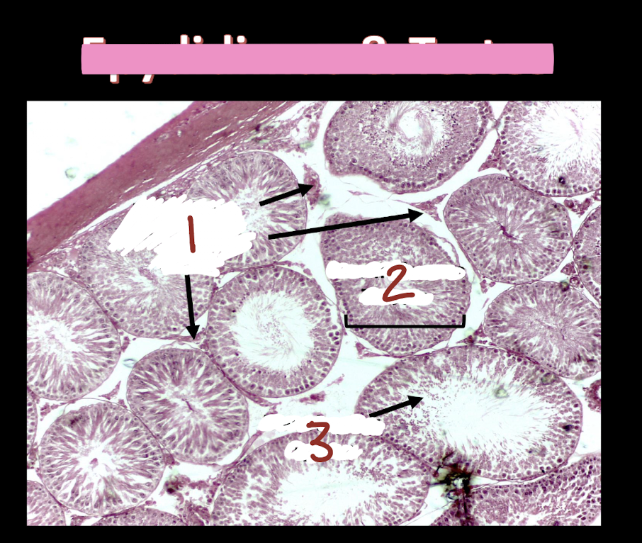 <p>What is number 1?</p>