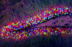 <p>… are produced when each neuron in the brain is tagged with a different colour and this enables us to examine cell … and … (neurons and targets)</p>