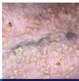 <ul><li><p>an immune-mediated disease with antibodies directed against desmocollin-1 (dogs) and desmoglein-1 (other species)</p></li><li><p>forms prominent pustules</p></li></ul><p></p>