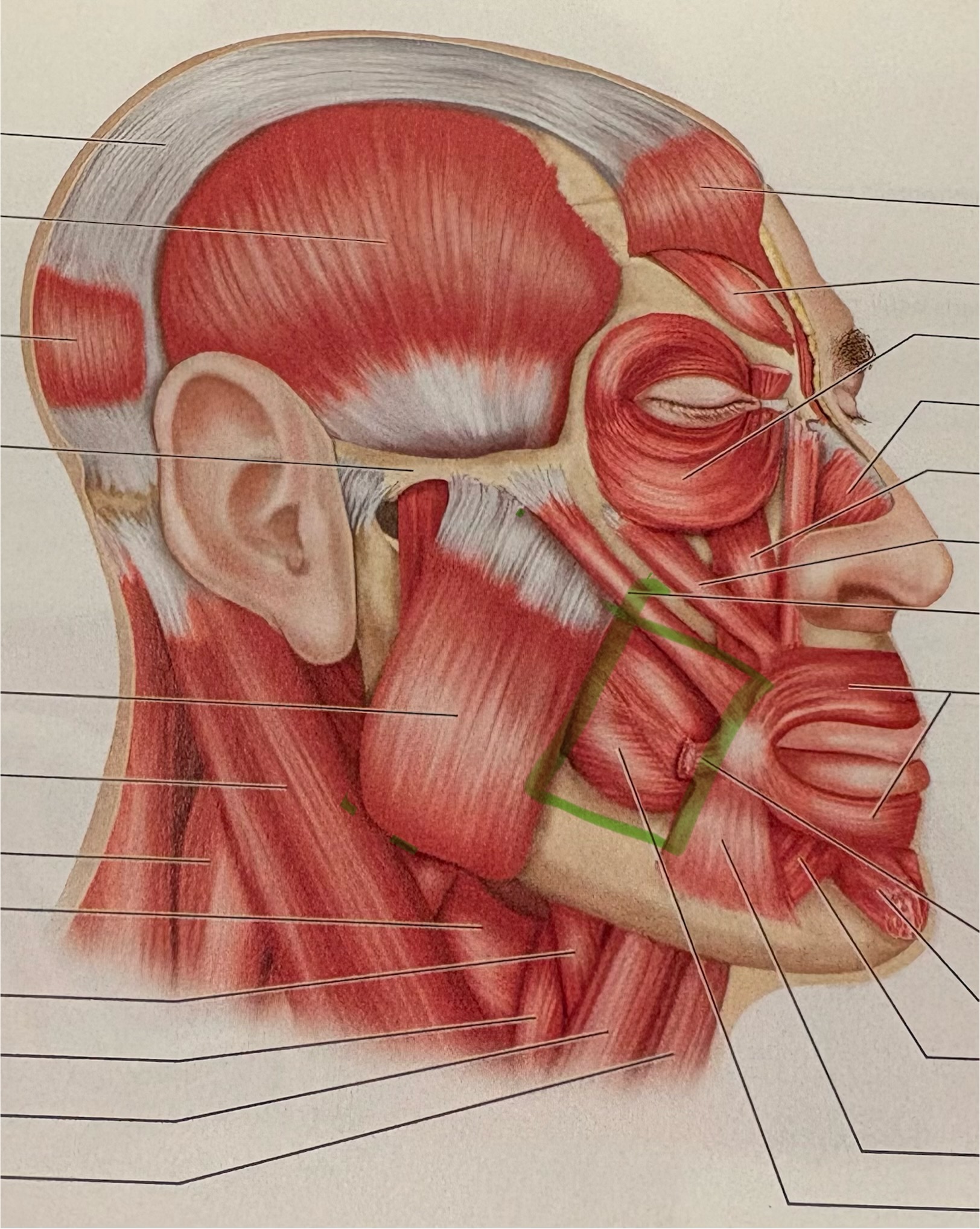 <p>what muscle is this?</p>