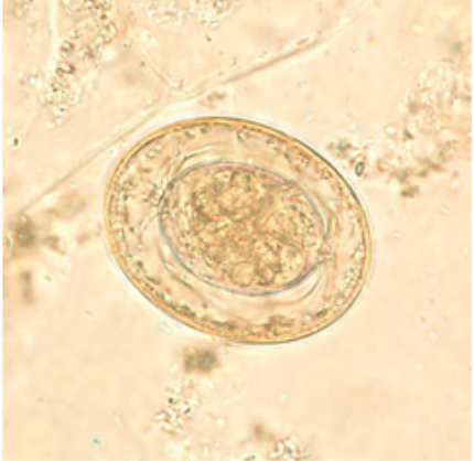 <p>Stool 31 x 43 um</p>