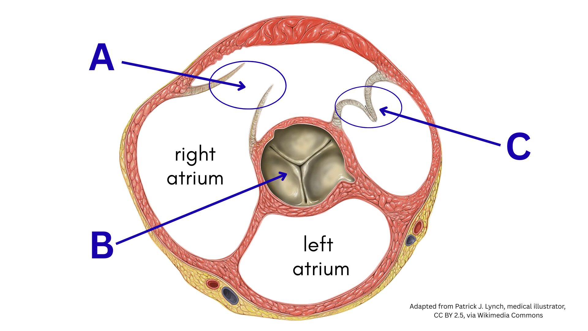 <p><span>What is the structure labeled <strong>A</strong> on the heart model below?</span></p>
