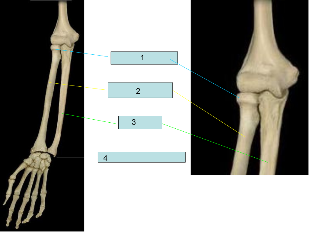 <p>what is #4 pointing at?</p>