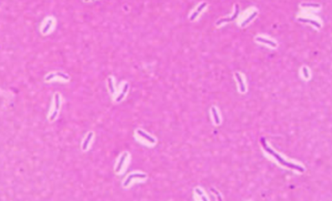 <p>What type of staining?</p>