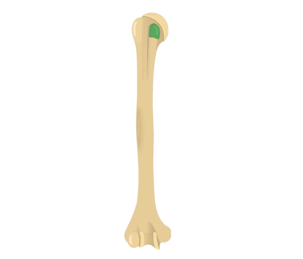 <p>A prominence on the proximal humerus, smaller than the greater tubercle.</p>