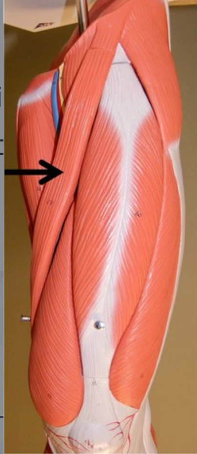 <p>origin: anterior superior iliac insertion: proximal end of tibia below medial condyle</p>