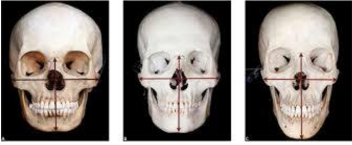 <p>Maximum dacial width measured across cheekbones </p>