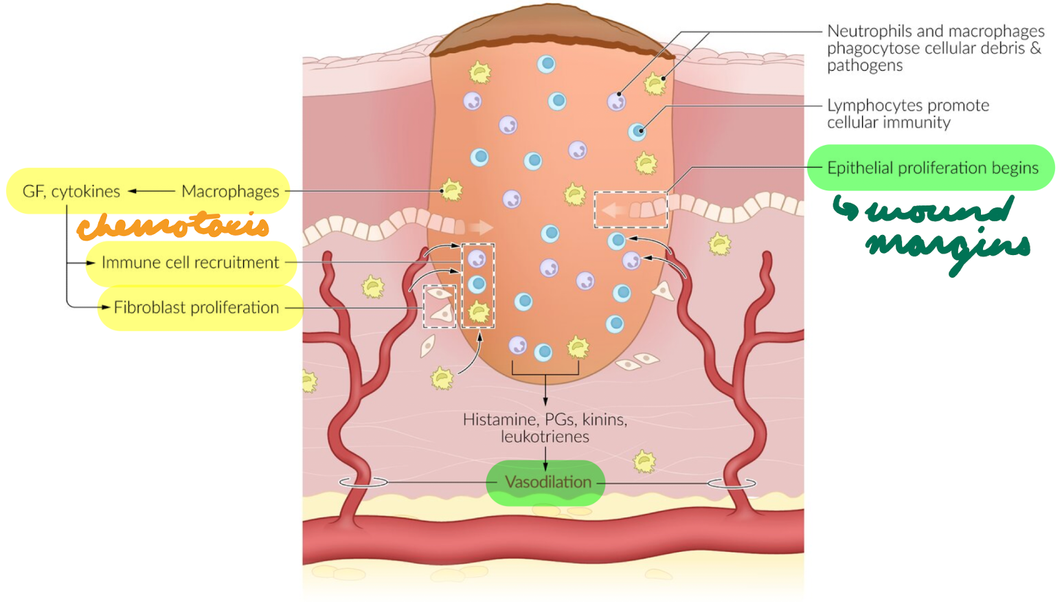 <p>Day 1-3</p><p>Chemotaxis = Recruit inflammatory cells</p><ul><li><p>Macrophages release growth factors + cytokines = Recruit more cells + stimulate fibroblast proliferation + resorb debris</p></li></ul><p>Vasodilation</p><p>Wound margins proliferate</p>