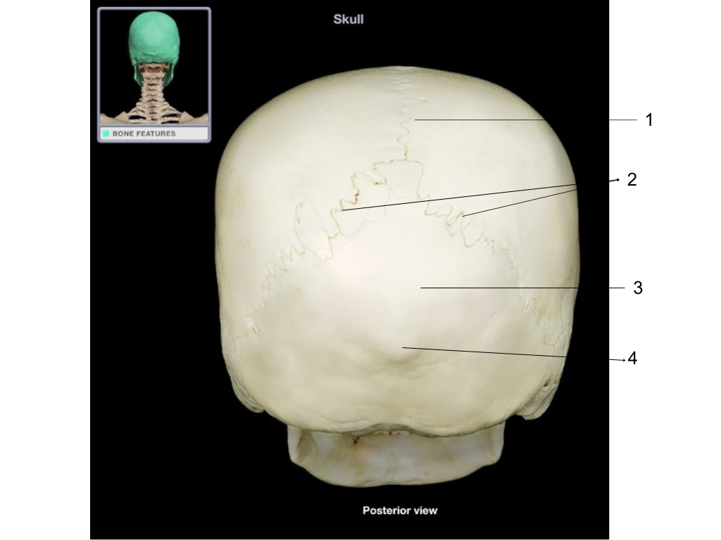 <p>what is #2 pointing at?</p>