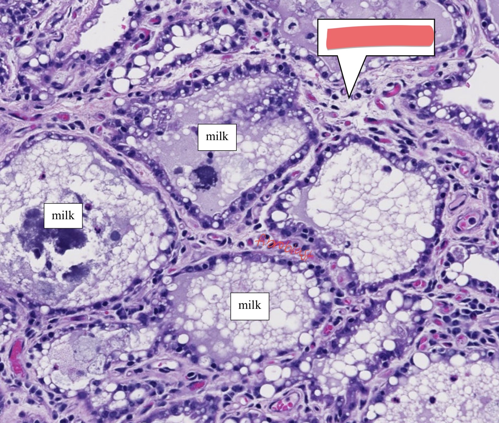 term image